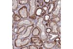 Immunohistochemical staining of human kidney shows strong cytoplasmic positivity in renal tubules.