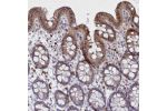Immunohistochemical staining of human colon shows moderate cytoplasmic and nuclear positivity in glandular cells.