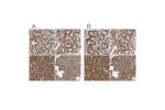 Immunohistochemical staining of human gastrointestinal, kidney, liver and pancreas using Anti-MUT antibody HPA035971 (A) shows similar protein distribution across tissues to independent antibody HPA035972 (B).
