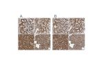 Immunohistochemical staining of human gastrointestinal, kidney, liver and pancreas using Anti-MUT antibody HPA035972 (A) shows similar protein distribution across tissues to independent antibody HPA035971 (B).