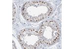 Immunohistochemical staining of human testis shows moderate nuclear positivity in cells in seminiferous ducts.