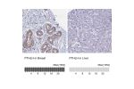 Immunohistochemistry analysis in human breast and liver tissues using HPA035982 antibody. Corresponding PTHLH RNA-seq data are presented for the same tissues.