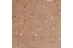 Immunohistochemical staining of human testis shows moderate cytoplasmic positivity in cells in seminiferous ducts.