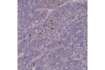 Immunohistochemical staining of human lymph node shows strong cytoplasmic positivity in a rare number of non-germinal center cells.