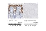 Immunohistochemistry analysis in human colon and skeletal muscle tissues using HPA036055 antibody. Corresponding SLC26A3 RNA-seq data are presented for the same tissues.