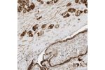 Immunohistochemical staining of human placenta shows strong cytoplasmic positivity in trophoblastic cells and decidual cells.