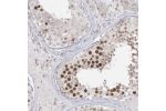 Immunohistochemical staining of human testis shows strong nuclear positivity in primary spermatocytes of seminiferous ducts..