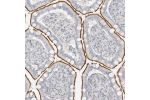 Immunohistochemical staining of human Small intestine shows moderate membranous positivity in glandular cells.