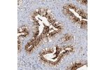 Immunohistochemical staining of human gallbladder shows strong granular positivity in cytoplasm in glandular cells.