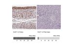Immunohistochemistry analysis in human ovary and pancreas tissues using Anti-ELK1 antibody. Corresponding ELK1 RNA-seq data are presented for the same tissues.