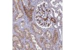 Immunohistochemical staining of human kidney shows distinct membranous positivity in cells in tubules and cells in glomeruli.