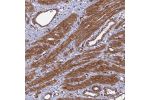Immunohistochemical staining of human smooth muscle shows moderate cytoplasmic positivity in myocytes.