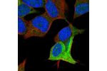 Immunofluorescent staining of human cell line SH-SY5Y shows localization to cytosol.