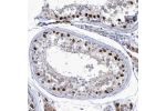 Immunohistochemical staining of human testis shows strong nuclear positivity in subsets of cells in seminiferus ducts.