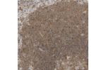 Immunohistochemical staining of human lymph node shows moderate to strong cytoplasmic positivity in germinal center cells.