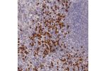 Immunohistochemical staining of human spleen shows strong cytoplasmic positivity in a subset of cells in red pulp.