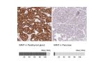 Immunohistochemistry analysis in human parathyroid gland and pancreas tissues using Anti-IMMT antibody. Corresponding IMMT RNA-seq data are presented for the same tissues.