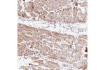 Immunohistochemical staining of human heart muscle shows moderate granular cytoplasmic positivity in cardiomyocytes.