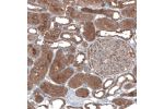 Immunohistochemical staining of human kidney shows moderate cytoplasmic positivity in cells in tubules.