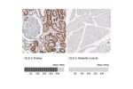Immunohistochemistry analysis in human kidney and skeletal muscle tissues using HPA036223 antibody. Corresponding GLS RNA-seq data are presented for the same tissues.