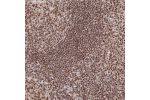 Immunohistochemical staining of human tonsil shows strong nuclear positivity.