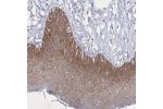 Immunohistochemical staining of human skin shows moderate cytoplasmic positivity in squamous epithelial cells.