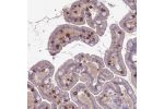 Immunohistochemical staining of human small intestine shows strong membranous positivity in lymphoid cells.
