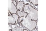 Immunohistochemical staining of human thyroid gland shows distinct cytoplasmic positivity in glandular cells.
