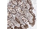 Immunohistochemical staining of human rectum shows cytoplasmic positivity in glandular cells.