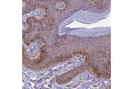 Immunohistochemical staining of human skin shows moderate to strong membranous positivity in keratinocytes.