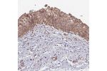 Immunohistochemical staining of human urinary bladder shows moderate membranous positivity in urothelial cells.