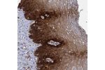 Immunohistochemical staining of human esophagus shows strong cytoplasmic positivity in squamous epithelial cells.