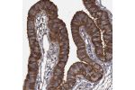 Immunohistochemical staining of human Fallopian tube shows strong cytoplasmic positivity in glandular cells.