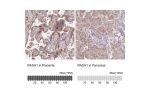 Immunohistochemistry analysis in human placenta and pancreas tissues using Anti-RASA1 antibody. Corresponding RASA1 RNA-seq data are presented for the same tissues.