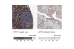 Immunohistochemistry analysis in human lymph node and skeletal muscle tissues using Anti-LCP2 antibody. Corresponding LCP2 RNA-seq data are presented for the same tissues.