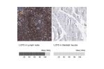 Immunohistochemistry analysis in human lymph node and skeletal muscle tissues using Anti-LCP2 antibody. Corresponding LCP2 RNA-seq data are presented for the same tissues.