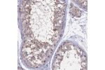 Immunohistochemical staining of human testis shows moderate cytoplasmic positivity in seminiferous ducts.