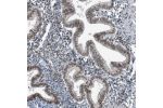 Immunohistochemical staining of human endometrium shows moderate nuclear positivity in glandular cells.
