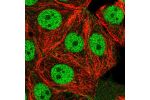 Immunofluorescent staining of human cell line MCF7 shows localization to nucleoplasm.