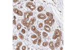 Immunohistochemical staining of human Breast shows strong membranous and cytoplasmic positivity in glandular cells.