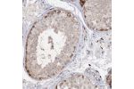 Immunohistochemical staining of human testis shows moderate cytoplasmic and membranous positivity in cells in seminiferous ducts.