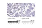 Immunohistochemistry analysis in human placenta and prostate tissues using HPA036630 antibody. Corresponding LIN28B RNA-seq data are presented for the same tissues.
