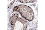 Immunohistochemical staining of human testis shows strong cytoplasmic positivity in spermatogonia.