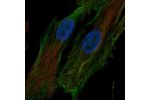 Immunofluorescent staining of human cell line LHCN-M2 shows localization to plasma membrane.