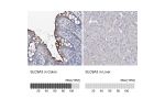 Immunohistochemistry analysis in human colon and liver tissues using HPA036669 antibody. Corresponding SLC9A3 RNA-seq data are presented for the same tissues.