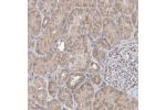 Immunohistochemical staining of human kidney shows moderate granular cytoplasmic positivity in cells in tubules.