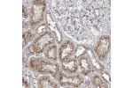 Immunohistochemical staining of human duodenum shows strong cytoplasmic positivity in glandular cells.