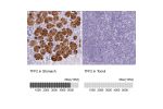 Immunohistochemistry analysis in human stomach and tonsil tissues using HPA036705 antibody. Corresponding TFF2 RNA-seq data are presented for the same tissues.