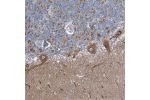 Immunohistochemical staining of human cerebellum shows distinct cytoplasmic positivity in purkinje cells.