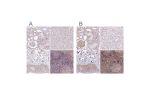 Immunohistochemical staining of human kidney, liver, skin and testis using Anti-GNL3 antibody HPA036742 (A) shows similar protein distribution across tissues to independent antibody HPA036743 (B).